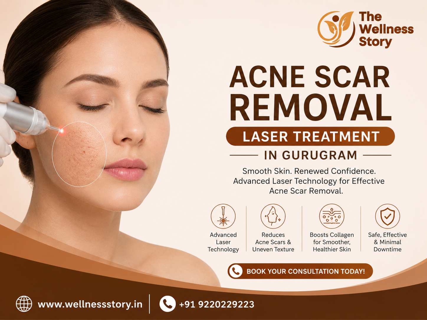  Acne Scar Removal Laser Treatment in Gurugram | Advanced Dermatology Care at Wellness Story