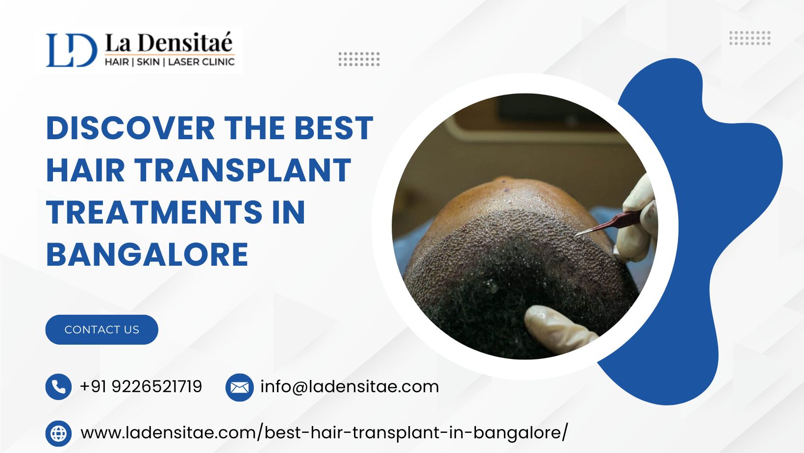  Discover the Best Hair Transplant Treatments in Bangalore