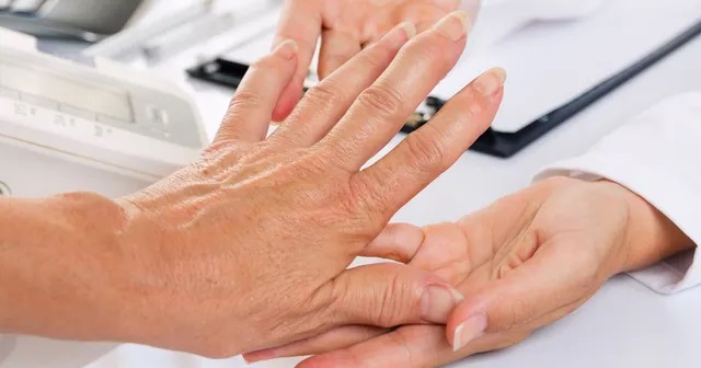  Powerful Migraine Treatment UES NY