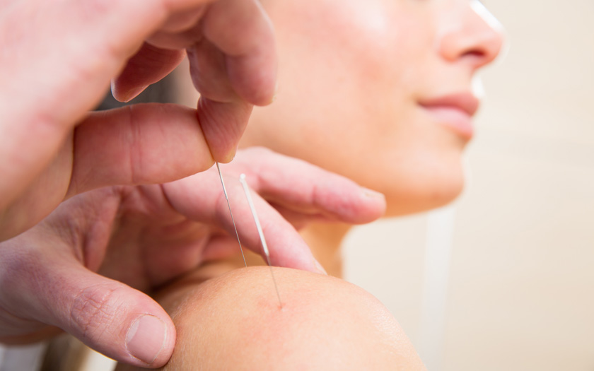  Acupuncture Therapy in San Francisco