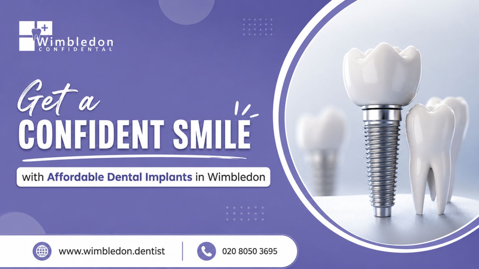  Get a Confident Smile with Affordable Dental Implants in Wimbledon