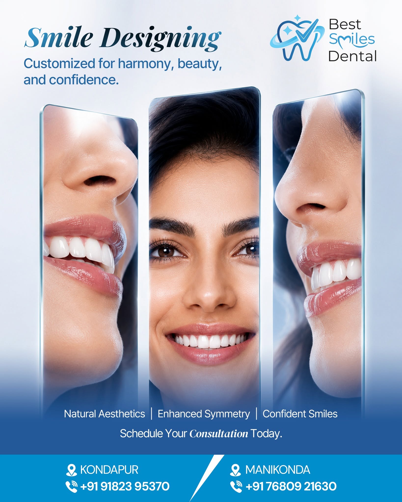  Smile Designing in Kondapur, Hyderabad – Best Smiles Dental