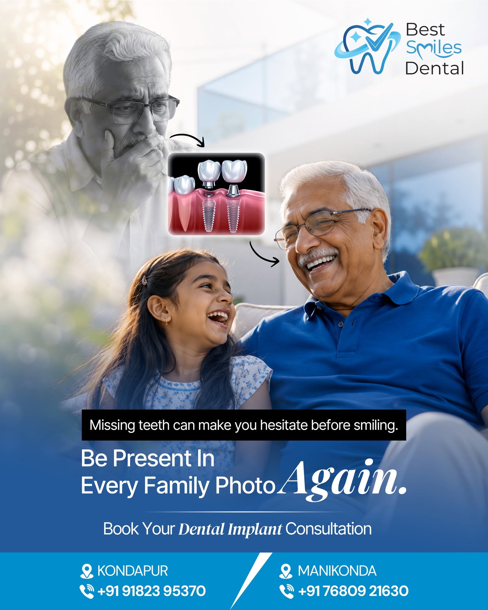  Dental Implants in Hyderabad – Best Smiles Dental