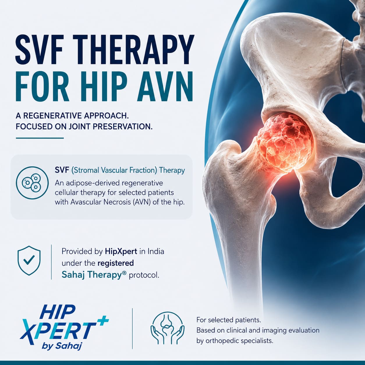  SVF Therapy for Hip AVN in India | Sahaj Therapy® by HipXpert