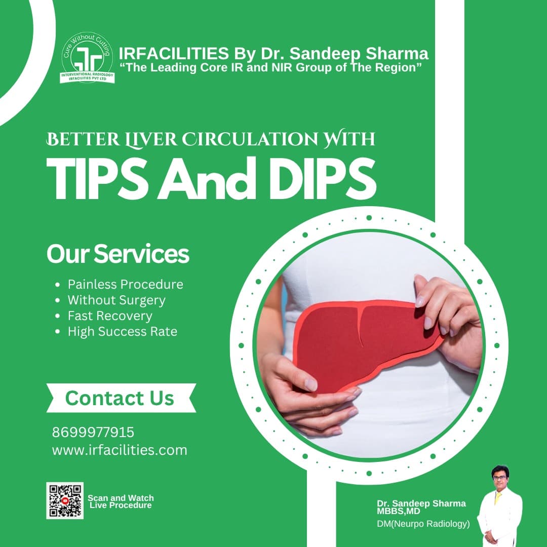  TIPS Procedure Radiology | Minimally Invasive Portal Hypertension Procedure