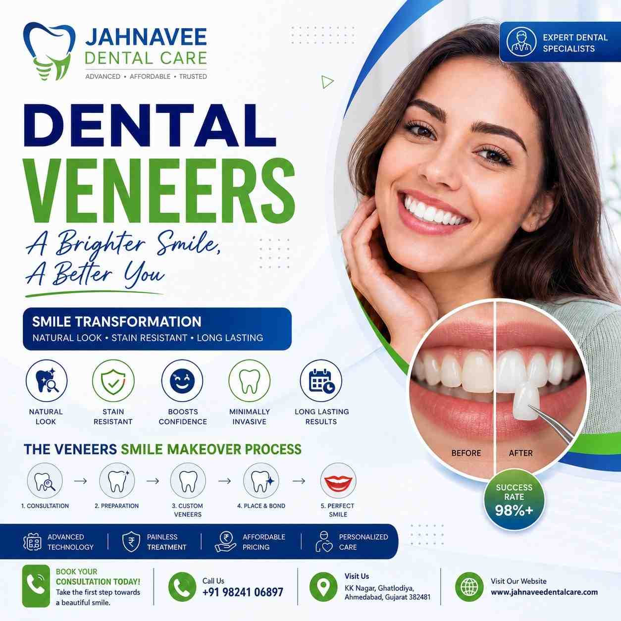  Cosmetic Dental Veneers Treatment - Jahnavee Dental care