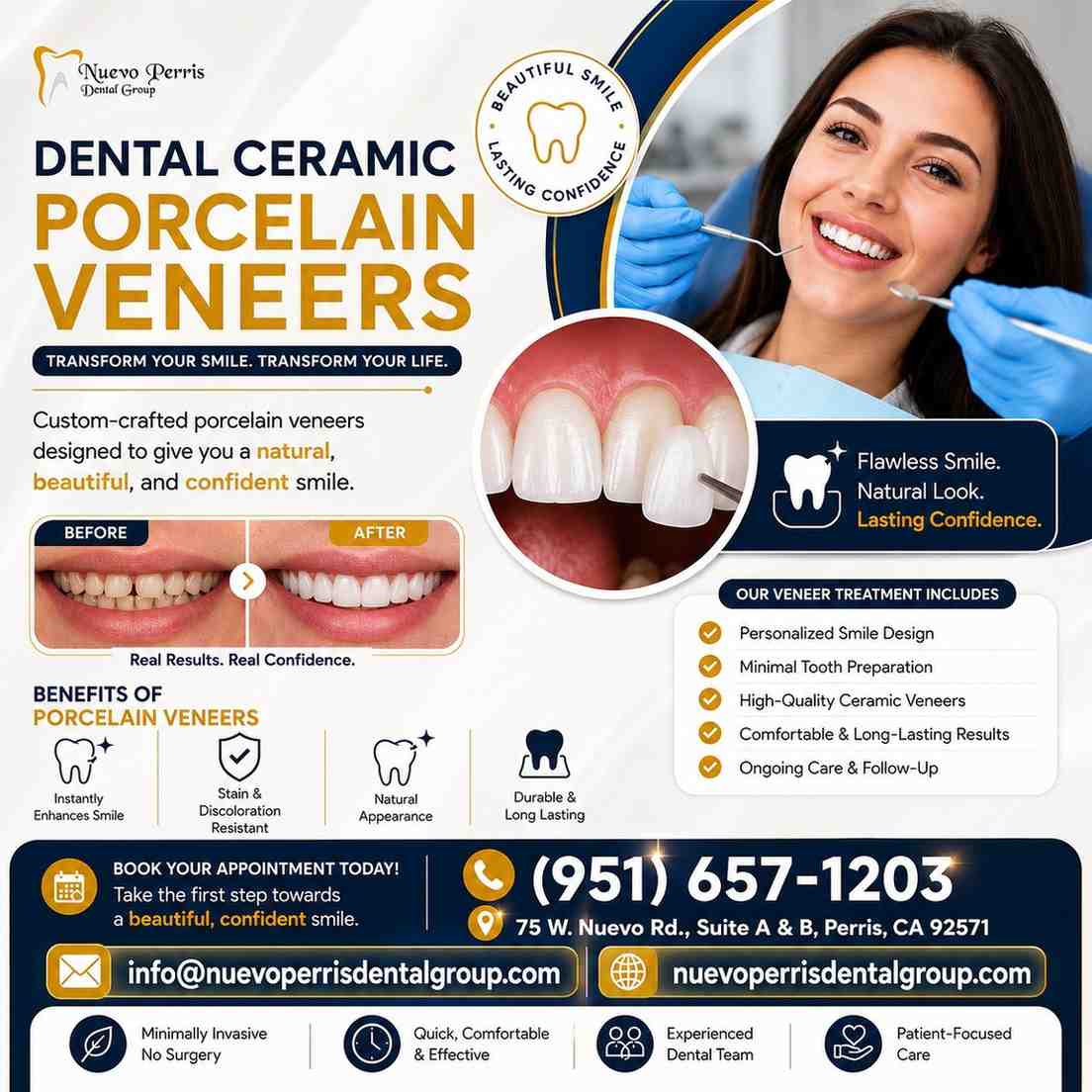  Dental Ceramic Porcelain Veneers California - Dr. Tejas Modi