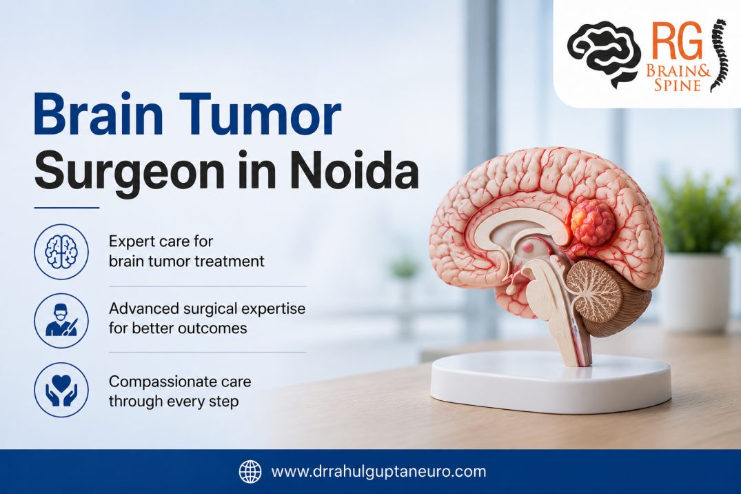  Experienced Brain Tumor Surgeon in Noida
