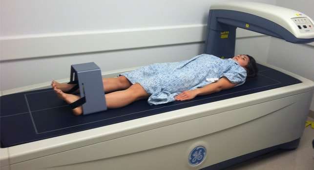  Bone Density Test Etobicoke