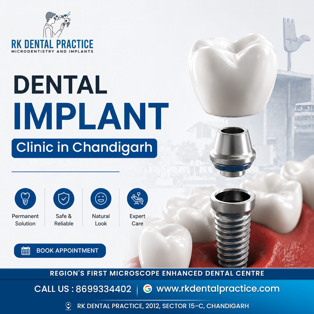  Dental Implant Clinic in Chandigarh for Advanced Tooth Replacement