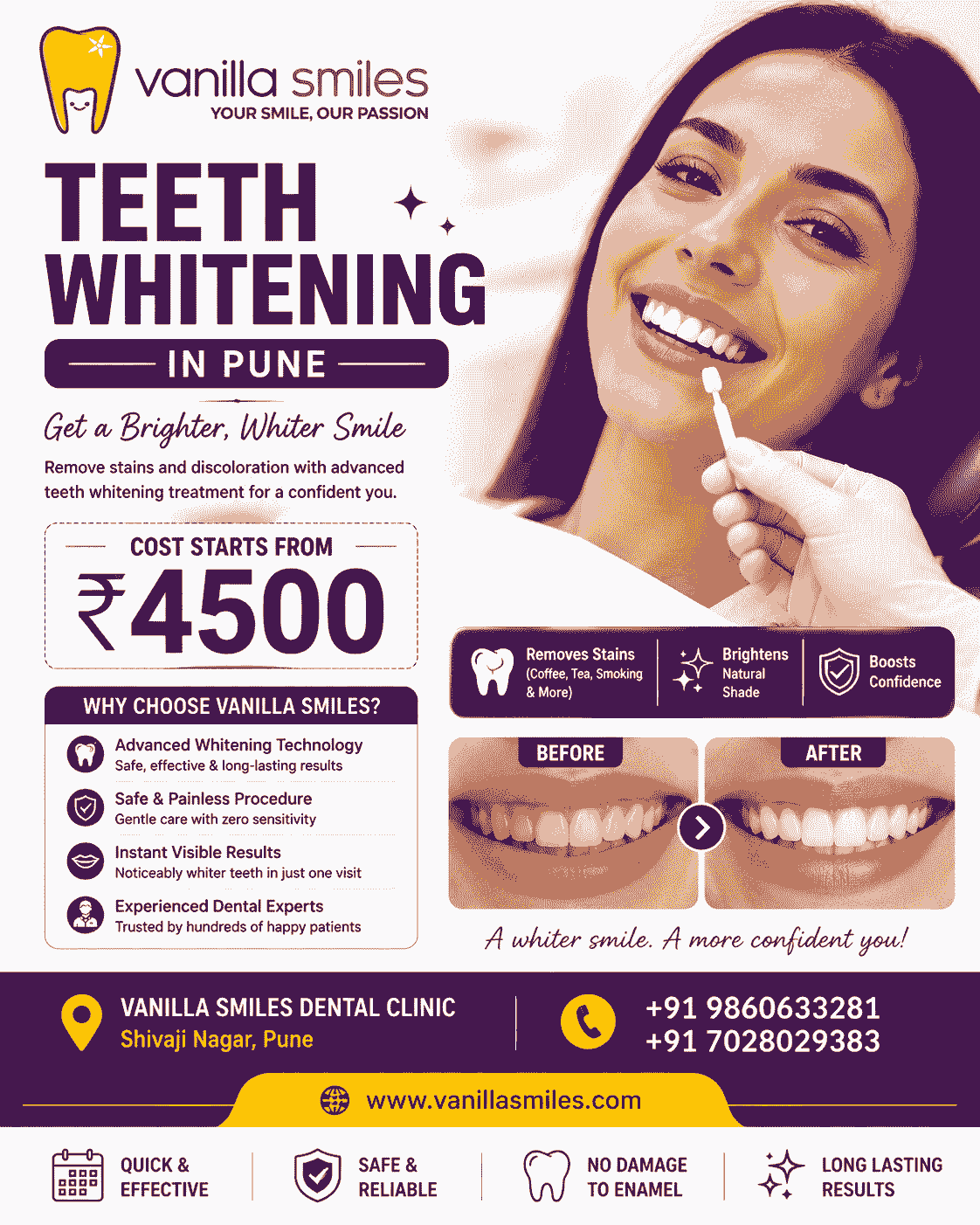  Affordable Teeth Whitening Treatment in Pune – Cost Starts From ₹4500