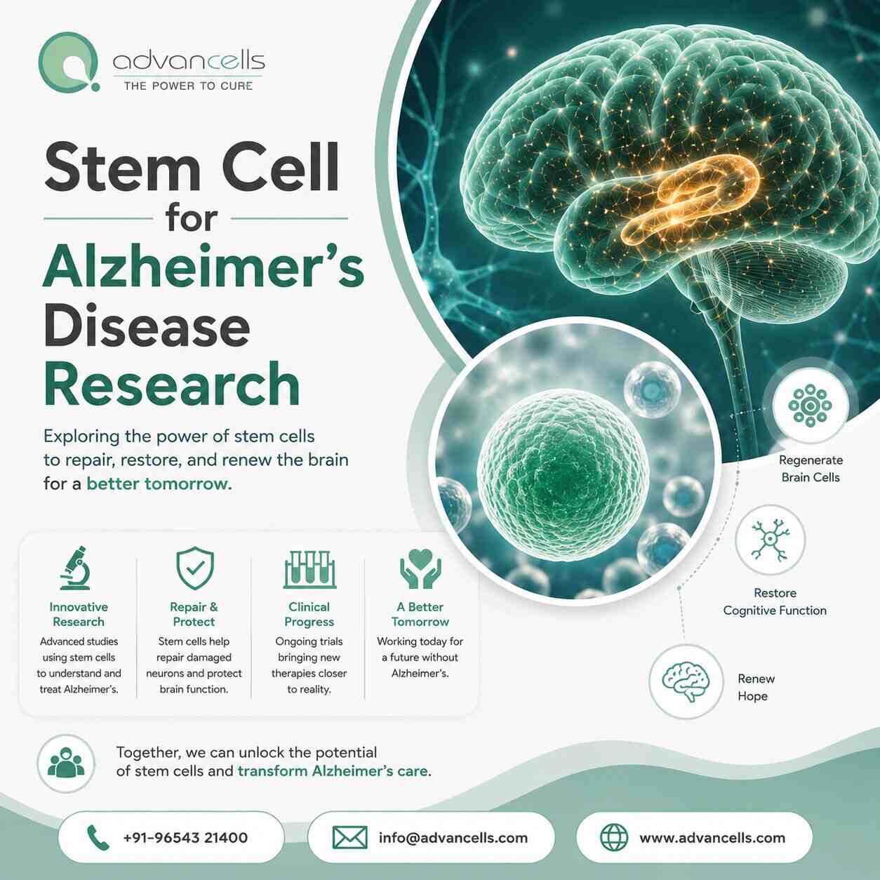  Stem Cell for Alzheimer's Disease Research