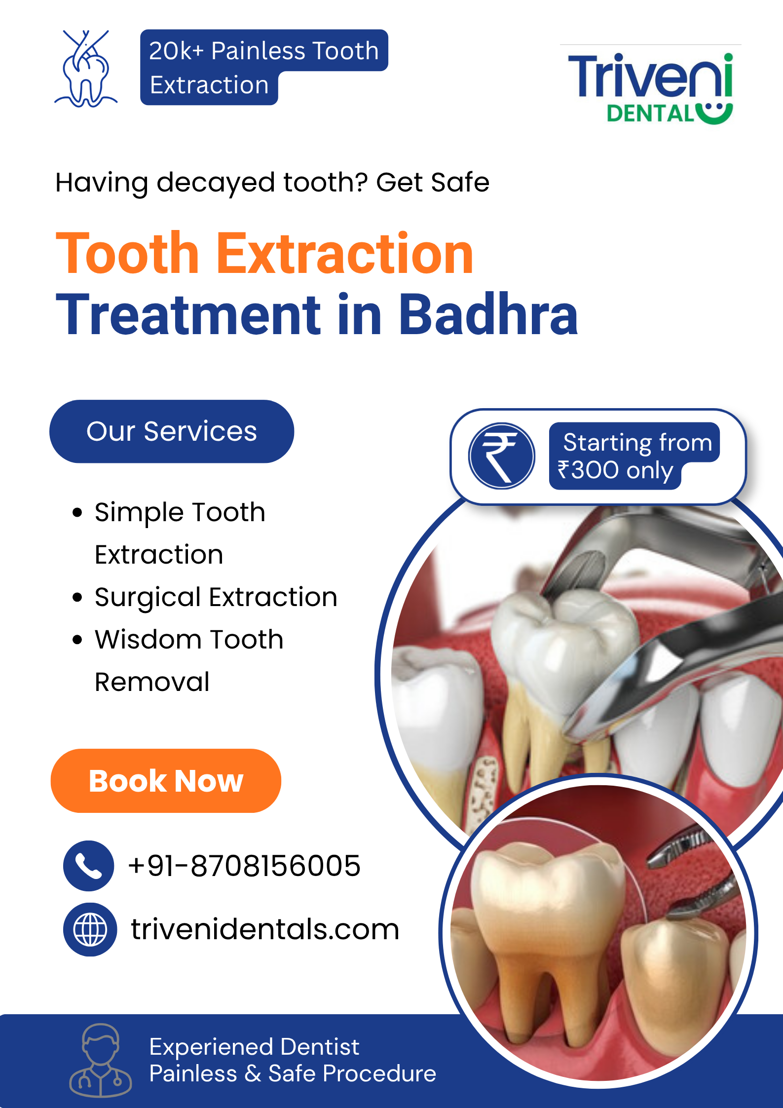  Tooth Extraction Treatment in Badhra | Triveni Dental
