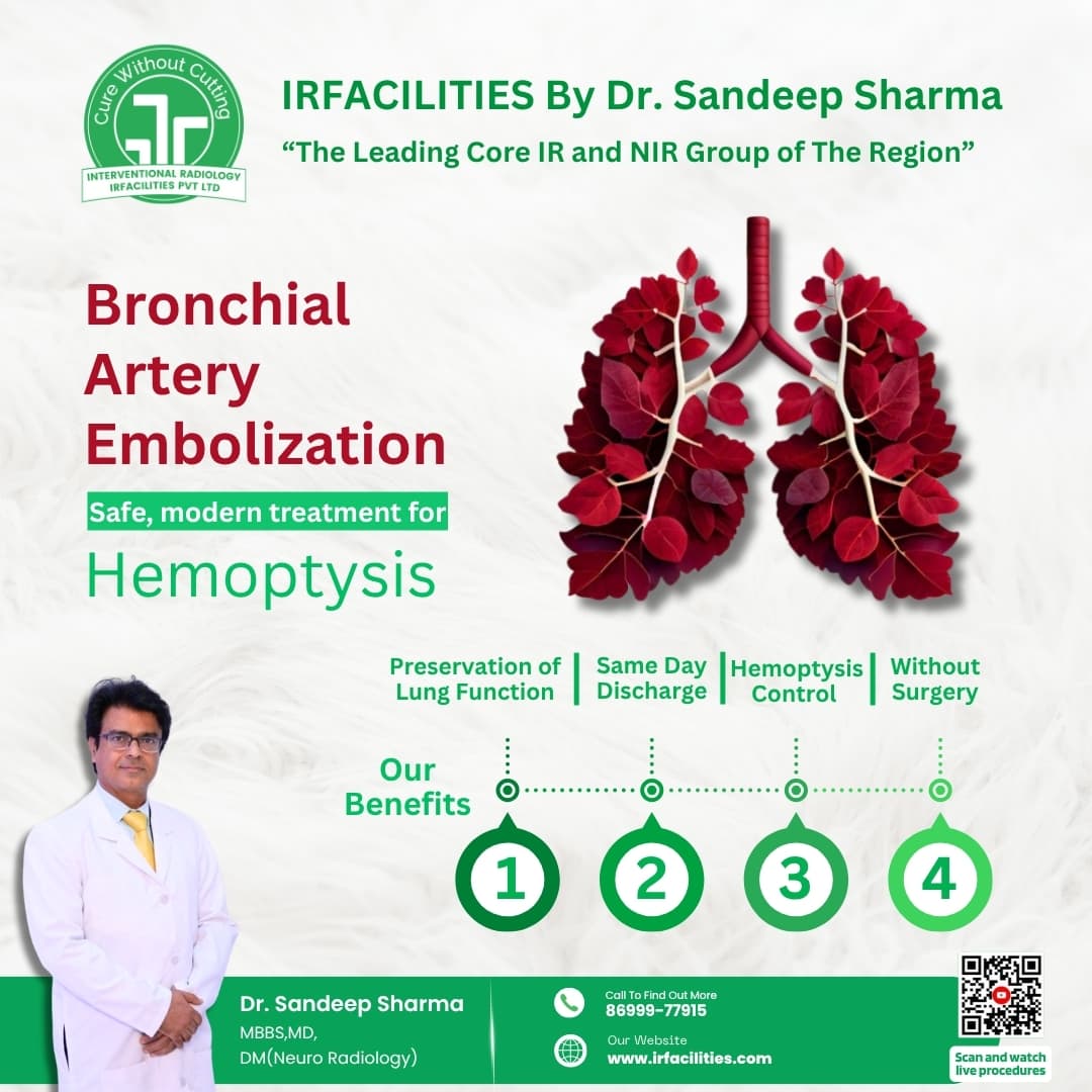  Bronchial Artery Embolization | Innovative Minimally Invasive Procedure
