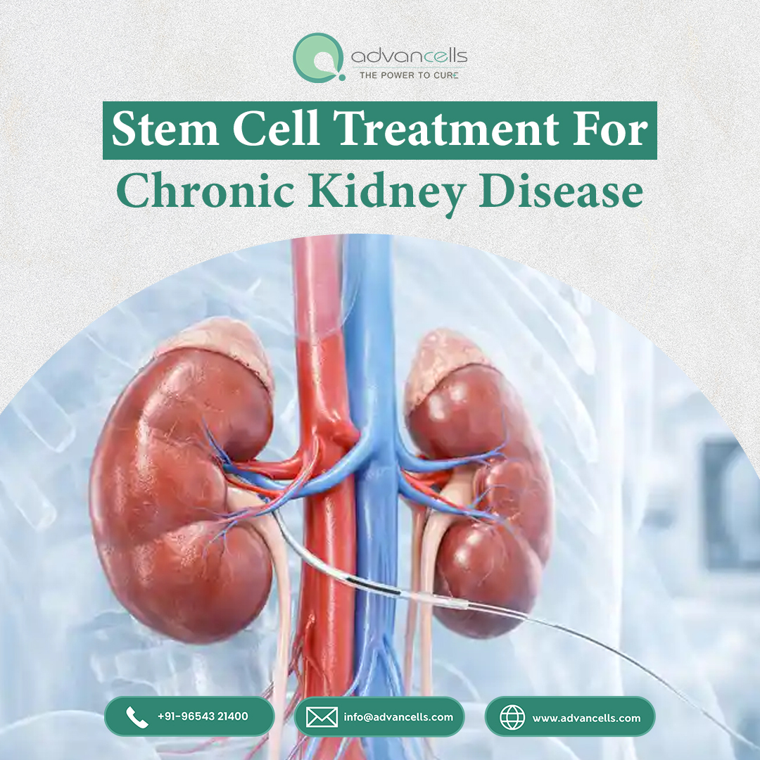  Stem Cell Treatment for Chronic Kidney Disease