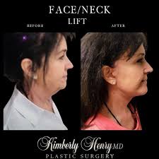  Bay Area Plastic Surgery