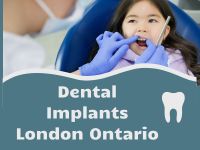  Dental Implants London Ontario: Restore Your Smile with Confidence