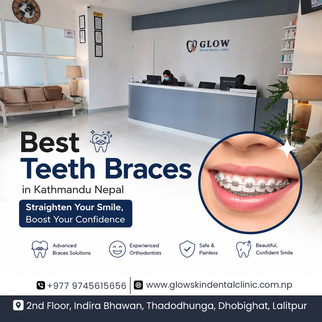  Best Teeth Braces in Kathmandu Nepal for Smiles