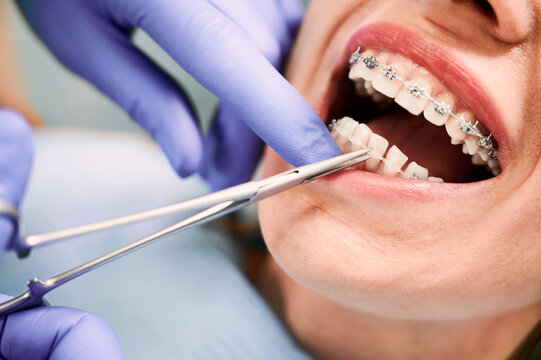  Best Orthodontist in Pune | Braces Treatment