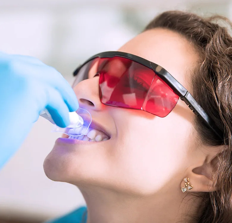  Best Smile Designing in Pune | Natural Smile Makeover