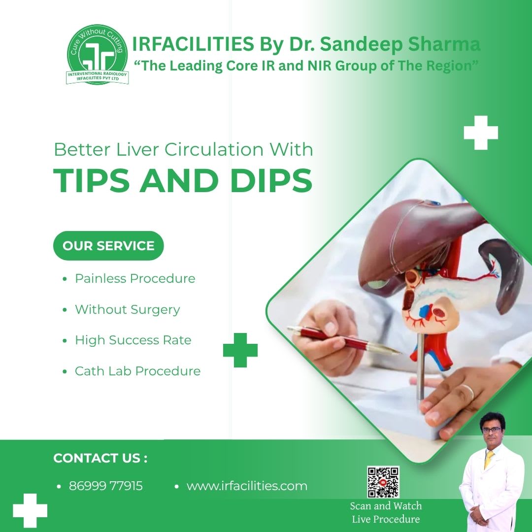  Transjugular Intrahepatic Portosystemic Shunt (TIPS) | State-of-the-art Liver Treatment at IRFacilities