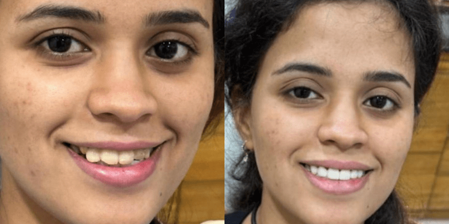  Cosmetic Dentistry In Andheri