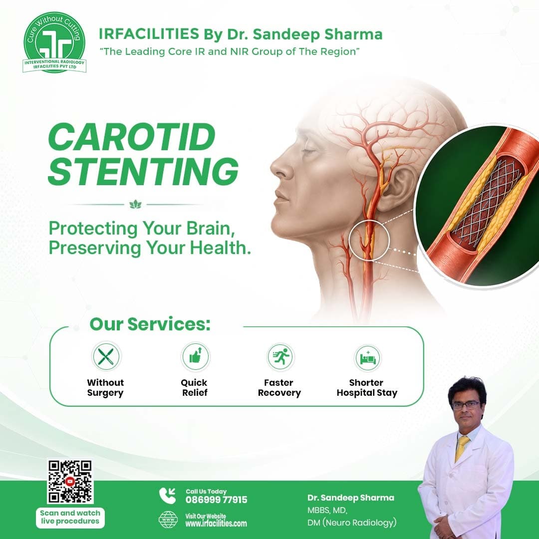  Carotid Artery Disease ICD 10 – Carotid Artery Disease ICD 10 Diagnosis and Treatment | IRFacilities