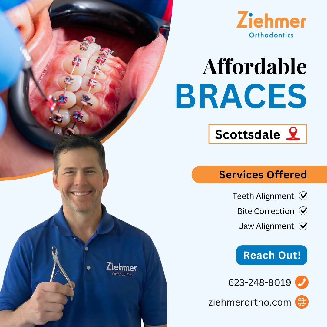  Affordable Braces Scottsdale