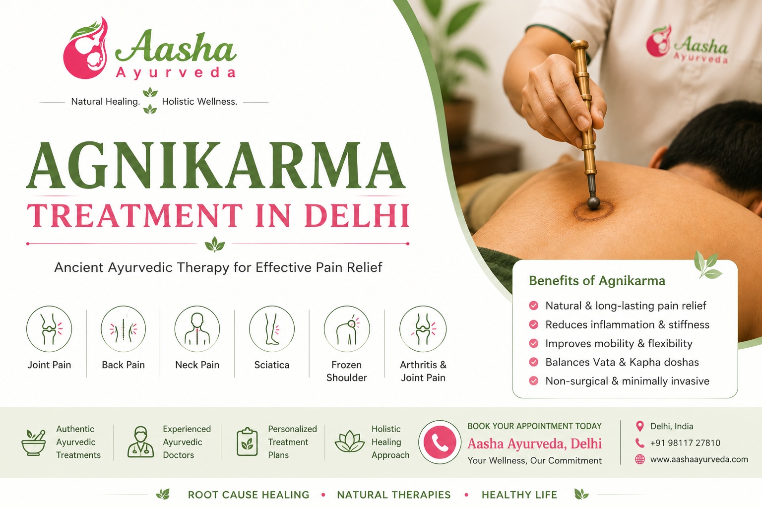  Agnikarma treatment in Delhi
