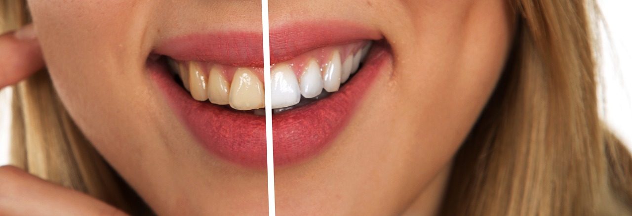  8 Benefits of Cosmetic Dentistry for Adults