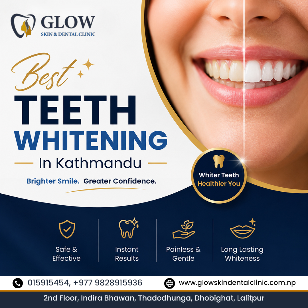  Best Teeth Whitening in Kathmandu for Brighter Smiles