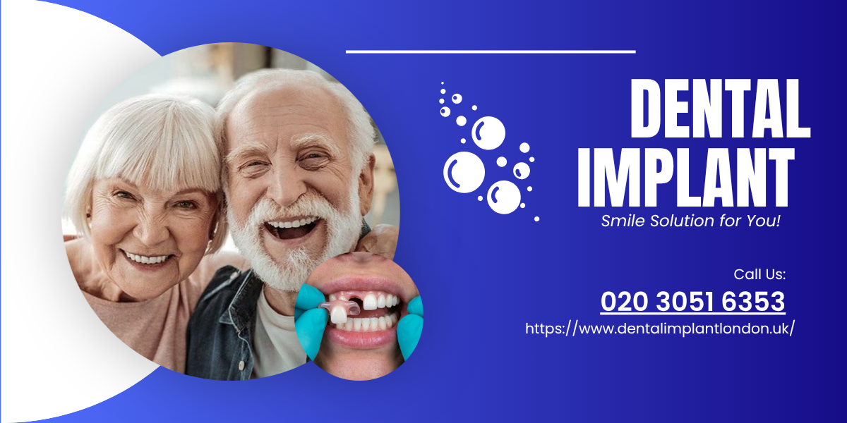  Trusted Dental Implants London Clinic – Book Today!