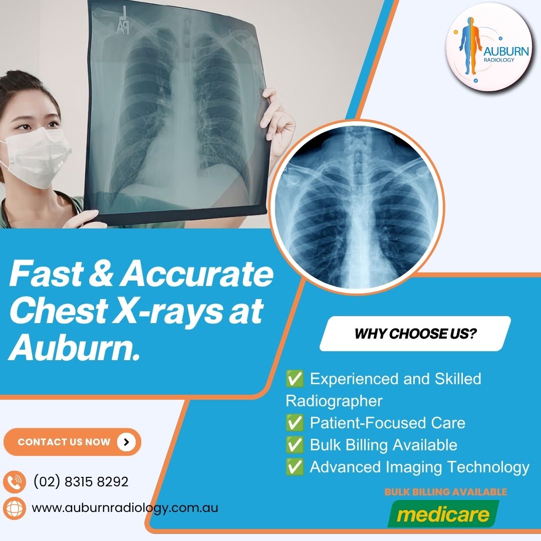  Fast & Accurate Chest X-Rays at Auburn Radiology. (02) 8315 8292