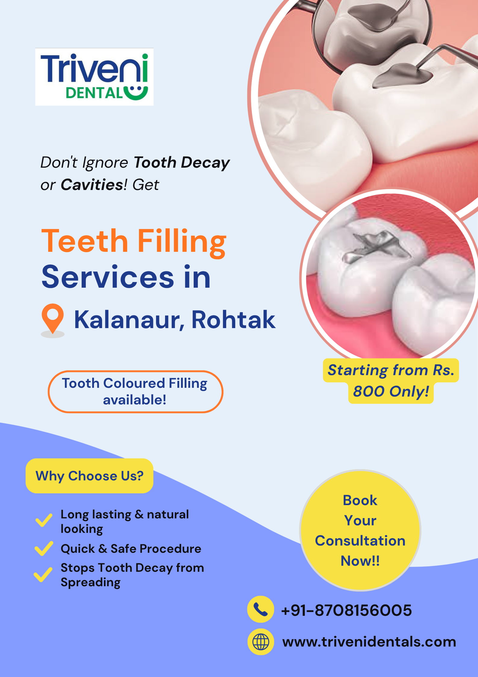  Tooth Filling Treatment in Kalanaur, Rohtak | Triveni Dental