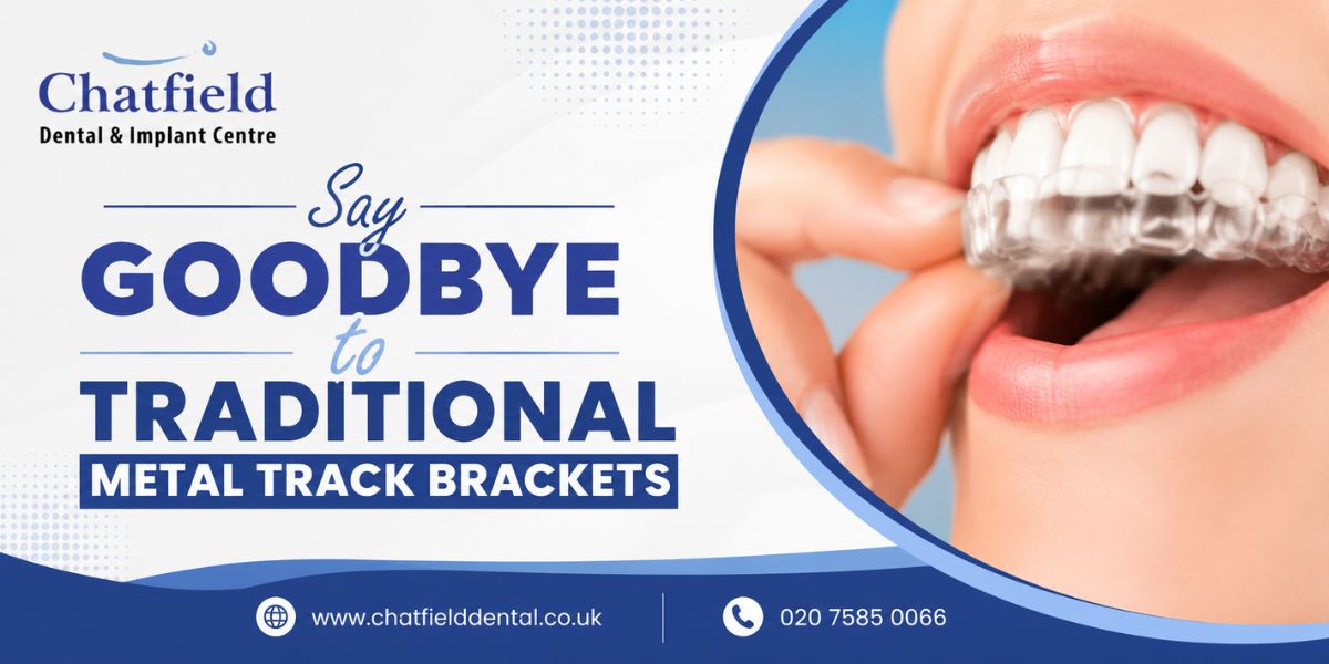  Say Goodbye to Traditional Metal Track Brackets