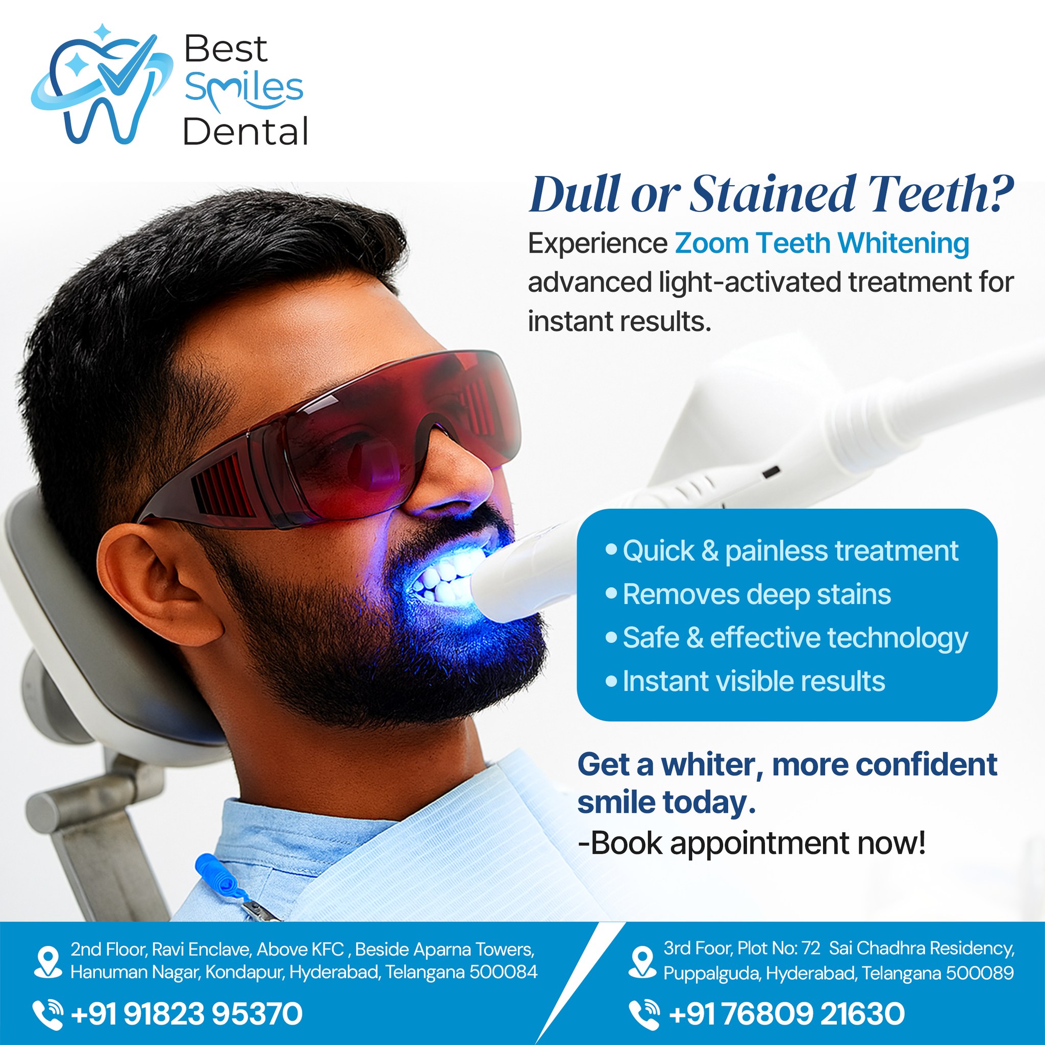  Zoom Teeth Whitening in Hyderabad - Best Smiles Dental