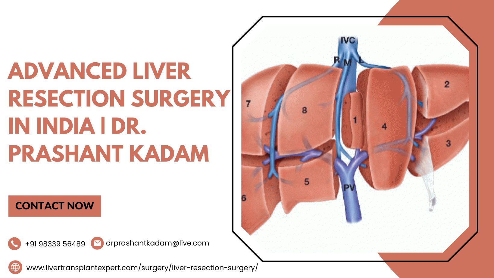 Advanced Liver Resection Surgery in India | Dr. Prashant Kadam