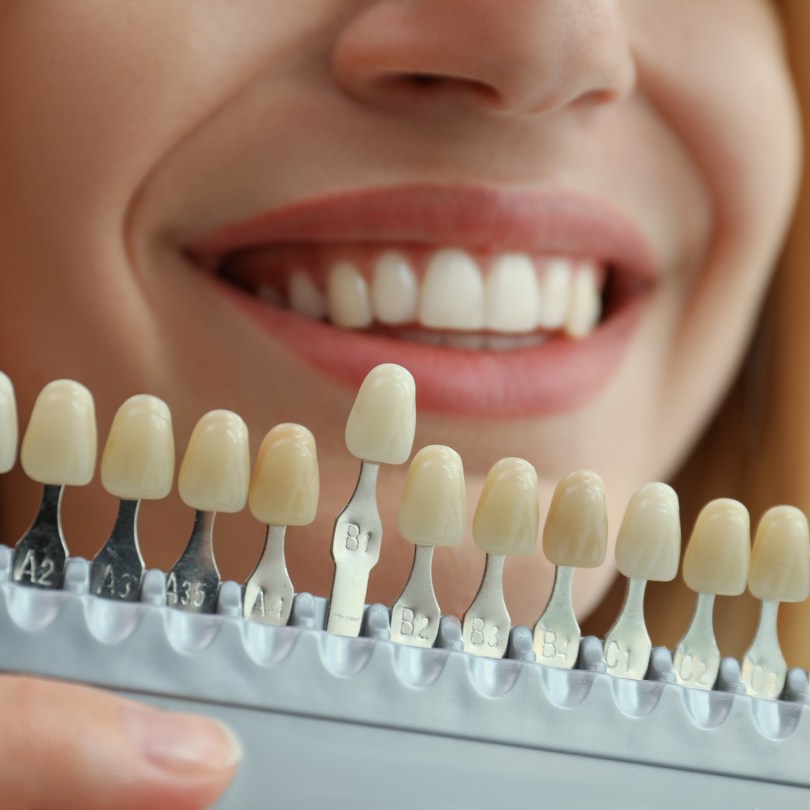  Dental Clinic in Viman Nagar Pune | Expert Dental Care & Implants