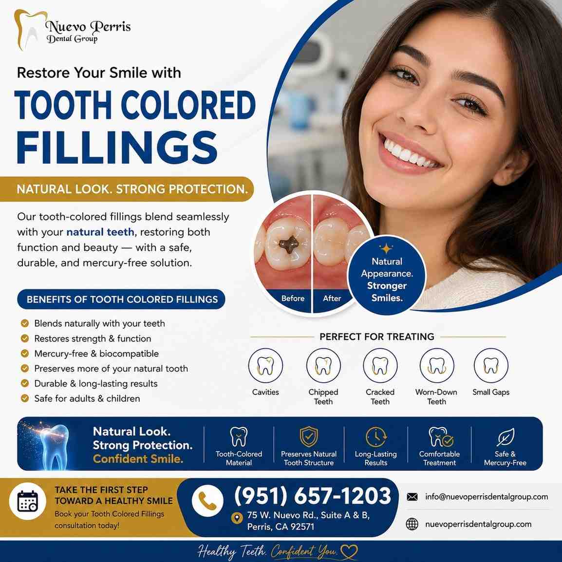  Tooth Colored Fillings Treatment in Moreno Valley – Nuevo