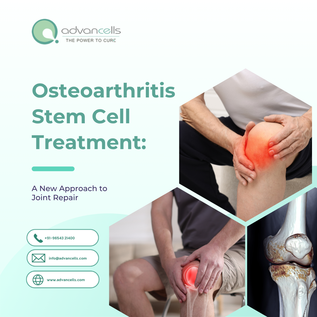  Osteoarthritis Stem Cell Treatment: A New Approach to Joint Repair