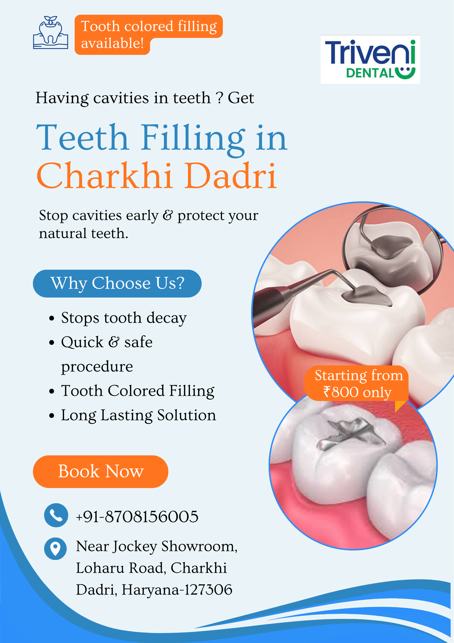  Affordable Teeth Filling in Charkhi Dadri | Triveni Dental