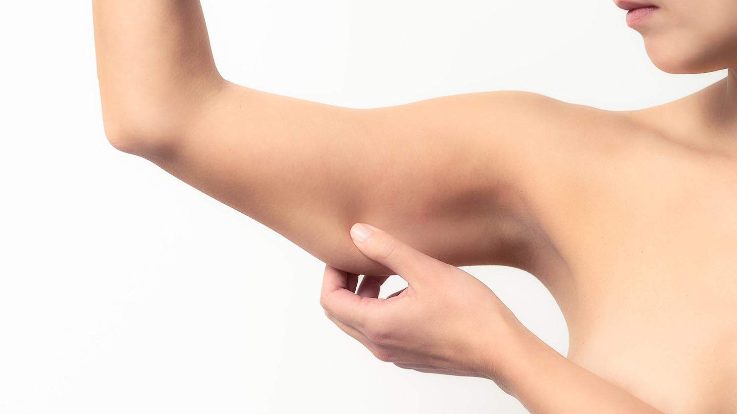 Arm Lift Surgery in Dubai