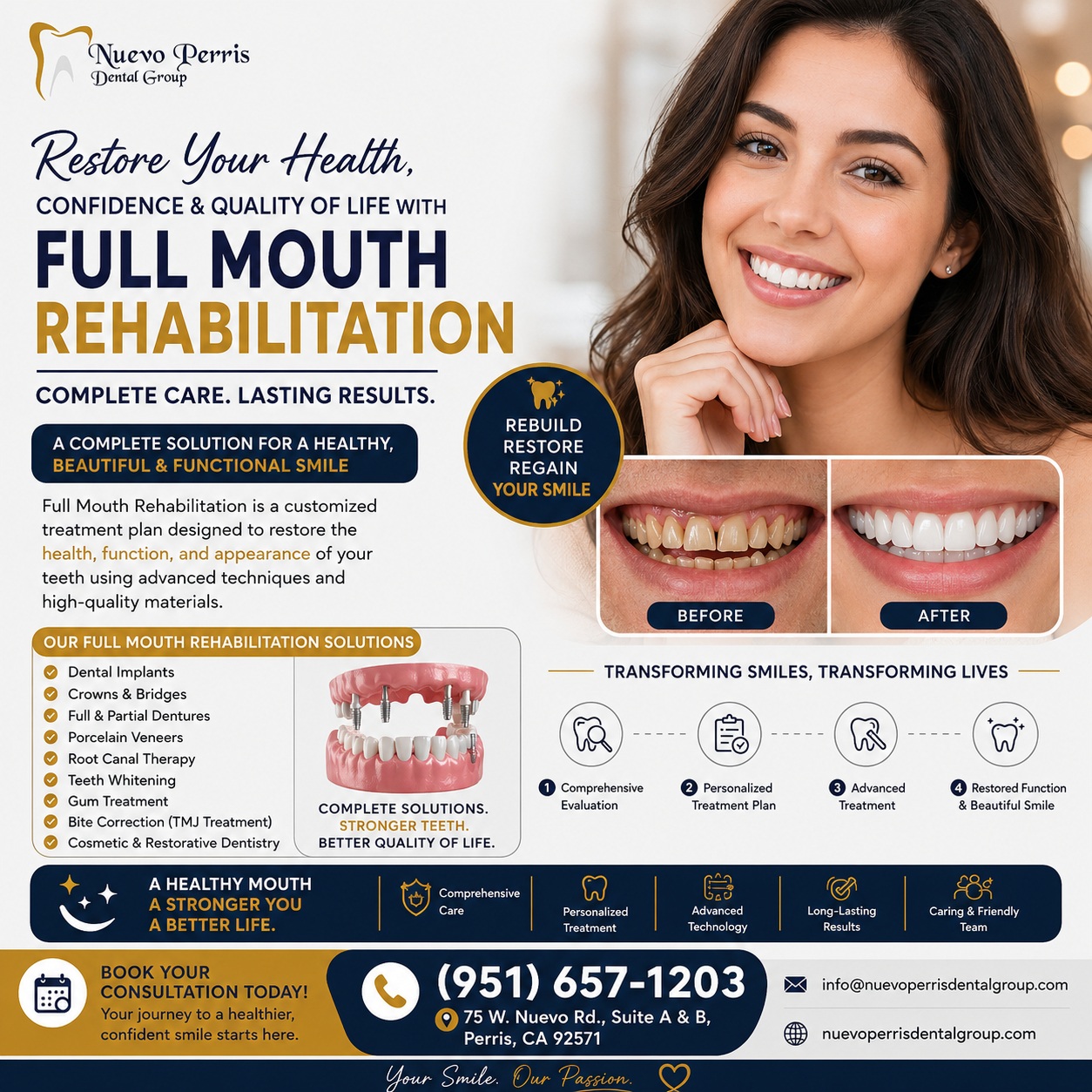  Full Mouth Rehabilitation treatment in Perris | Restore Smile