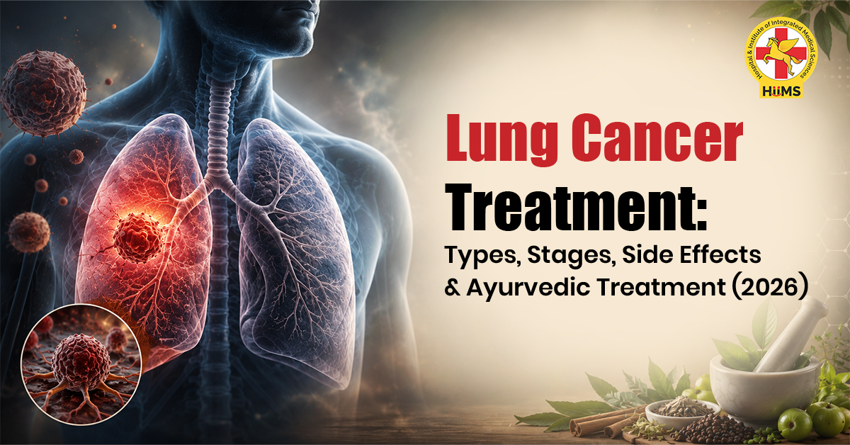  Lung Cancer Treatment: Types, Stages & Ayurvedic Treatment (2026)