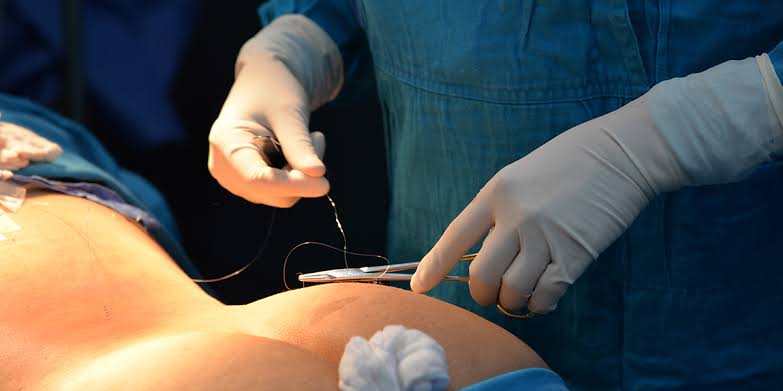  Buttock Augmentation Surgery in Dubai