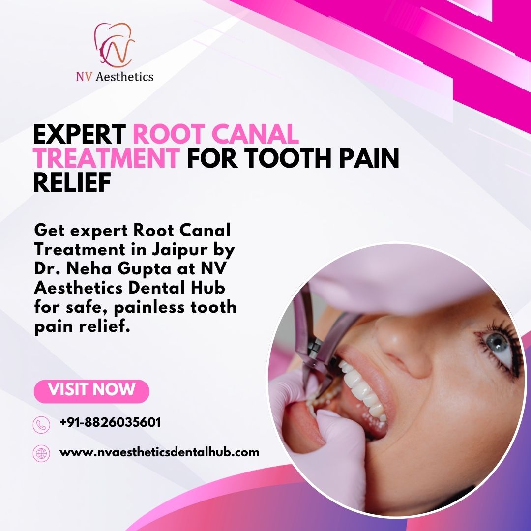  Expert Root Canal Treatment for Tooth Pain Relief
