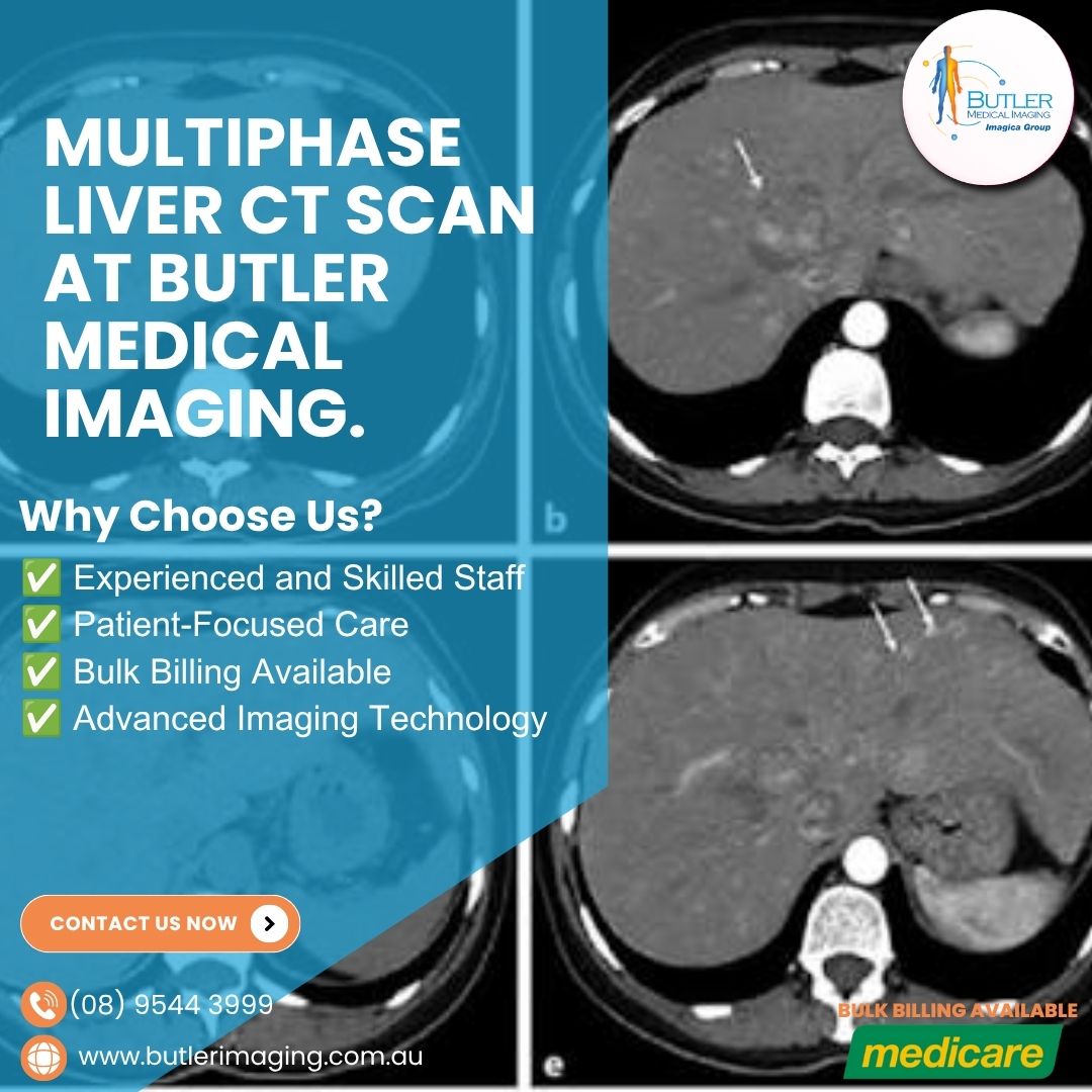  Multiphase Liver CT Scan at Butler Medical Imaging. (08) 9544 3999