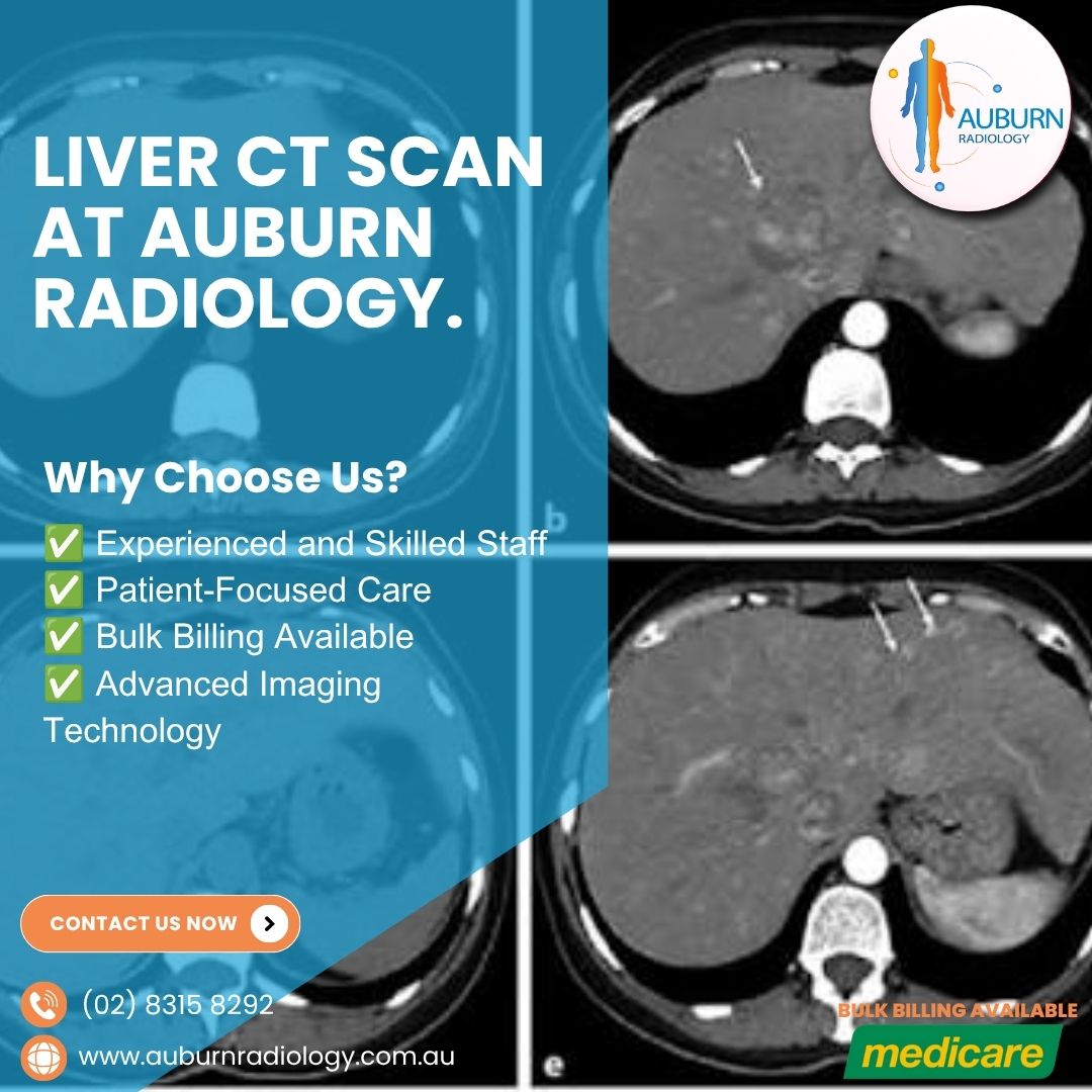  Liver CT Scan at Auburn Radiology. (02) 8315 8292