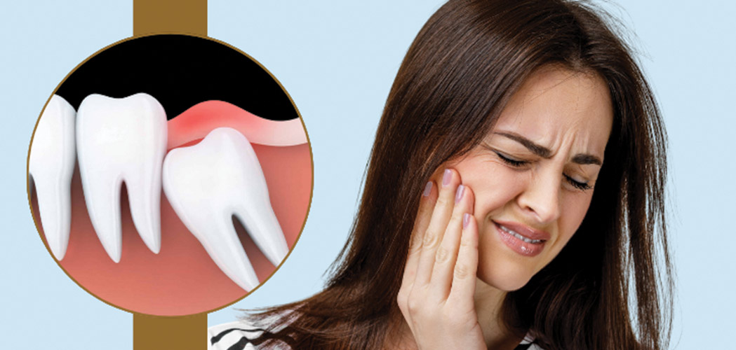  Wisdom Tooth Pain Relief: What Actually Works Before You See a Dentist