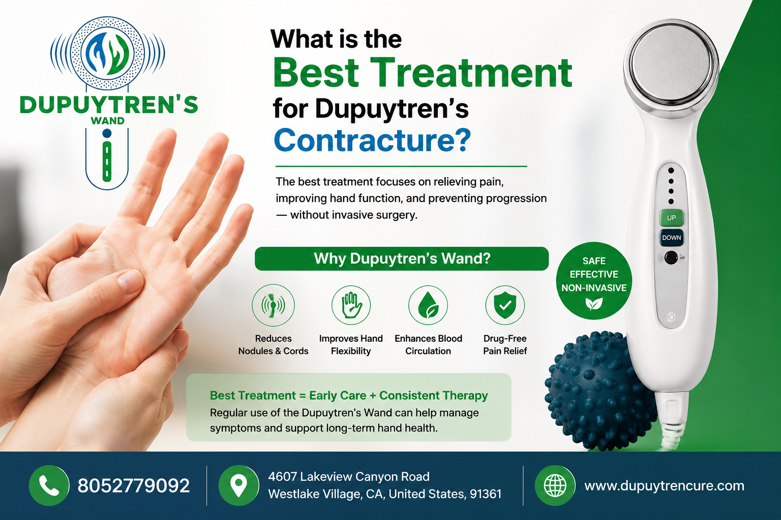  What is the best treatment for Dupuytren's contracture?